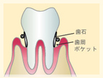 第3段階